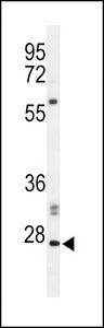 APOBEC3A Antibody - Western blot of hPHO1-M1 in Jurkat cell line lysates (35 ug/lane). PHO1 (arrow) was detected using the purified antibody.