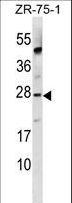 APOBEC3A Antibody - APOBEC3A Antibody western blot of ZR-75-1 cell line lysates (35 ug/lane). The APOBEC3A antibody detected the APOBEC3A protein (arrow).