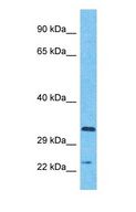 APOBEC3A Antibody - Western blot of ABC3A Antibody with human Fetal Kidney lysate.  This image was taken for the unconjugated form of this product. Other forms have not been tested.