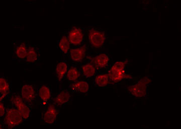 APOBEC3A Antibody - Staining HeLa cells by IF/ICC. The samples were fixed with PFA and permeabilized in 0.1% Triton X-100, then blocked in 10% serum for 45 min at 25°C. The primary antibody was diluted at 1:200 and incubated with the sample for 1 hour at 37°C. An Alexa Fluor 594 conjugated goat anti-rabbit IgG (H+L) Ab, diluted at 1/600, was used as the secondary antibody.