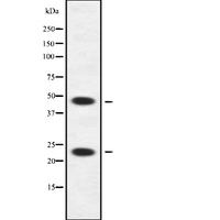 APOBEC3A Antibody - Western blot analysis of APOBEC3A/B using HuvEc whole cells lysates