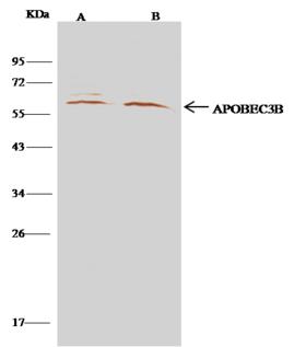 APOBEC3B Antibody - APOBEC3B was immunoprecipitated using: Lane A: 0.5 mg 293T Whole Cell Lysate. Lane B: 0.5 mg HepG2 Whole Cell Lysate. 4 uL anti-APOBEC3B rabbit polyclonal antibody and 15 ul of 50% Protein G agarose. Primary antibody: Anti-APOBEC3B rabbit polyclonal antibody, at 1:100 dilution. Secondary antibody: Clean-Blot IP Detection Reagent (HRP) at 1:500 dilution. Developed using the DAB staining technique. Performed under reducing conditions. Predicted band size: 46 kDa. Observed band size: 46 kDa.