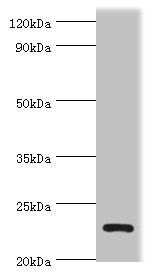 APOBEC3C Antibody - Western blot All lanes: APOBEC3C antibody at 3µg/ml + K562 whole cell lysate Secondary Goat polyclonal to rabbit IgG at 1/10000 dilution Predicted band size: 23 kDa Observed band size: 23 kDa