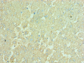 APOBEC3C Antibody - Immunohistochemistry of paraffin-embedded human liver tissue using APOBEC3C Antibody at dilution of 1:100