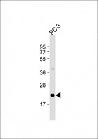 APOBEC3C Antibody - Anti-APOBEC3C Antibody (C-Term) at 1:2000 dilution + PC-3 whole cell lysate Lysates/proteins at 20 µg per lane. Secondary Goat Anti-Rabbit IgG, (H+L), Peroxidase conjugated at 1/10000 dilution. Predicted band size: 23 kDa Blocking/Dilution buffer: 5% NFDM/TBST.