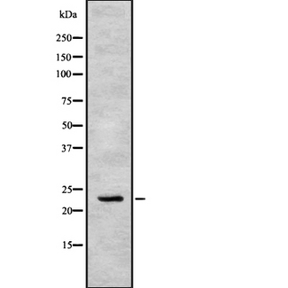 APOBEC3C Antibody - Western blot analysis of APOBEC3C using COLO205 whole cells lysates