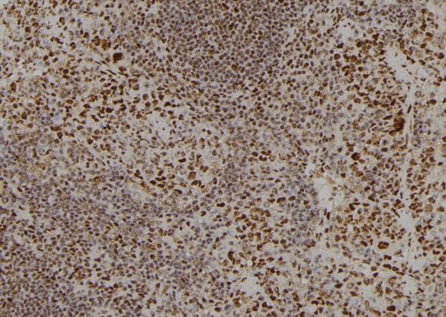 APOBEC3C Antibody - 1:100 staining mouse spleen tissue by IHC-P. The sample was formaldehyde fixed and a heat mediated antigen retrieval step in citrate buffer was performed. The sample was then blocked and incubated with the antibody for 1.5 hours at 22°C. An HRP conjugated goat anti-rabbit antibody was used as the secondary.