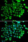 APOBEC3C Antibody - Immunofluorescence analysis of U2OS cells using APOBEC3C Polyclonal Antibody.