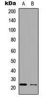APOBEC3C Antibody - Western blot analysis of APOBEC3C expression in HepG2 (A); PC12 (B) whole cell lysates.