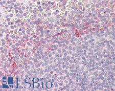 APOBEC3D Antibody - Human Spleen: Formalin-Fixed, Paraffin-Embedded (FFPE)