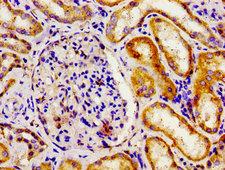 APOBEC3D Antibody - Immunohistochemistry image of paraffin-embedded human kidney tissue at a dilution of 1:100