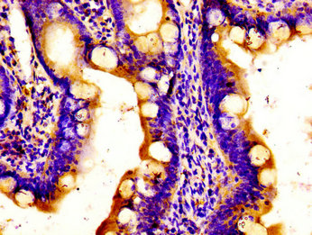 APOBEC3D Antibody - Immunohistochemistry image of paraffin-embedded human small intestine tissue at a dilution of 1:100