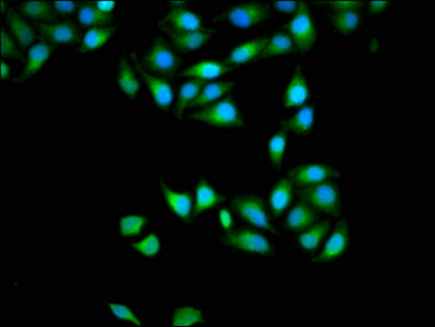 APOBEC3D Antibody - Immunofluorescence staining of Hela cells with APOBEC3D Antibody at 1:133, counter-stained with DAPI. The cells were fixed in 4% formaldehyde, permeabilized using 0.2% Triton X-100 and blocked in 10% normal Goat Serum. The cells were then incubated with the antibody overnight at 4°C. The secondary antibody was Alexa Fluor 488-congugated AffiniPure Goat Anti-Rabbit IgG(H+L).
