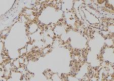 APOBEC3D Antibody - 1:100 staining rat lung tissue by IHC-P. The sample was formaldehyde fixed and a heat mediated antigen retrieval step in citrate buffer was performed. The sample was then blocked and incubated with the antibody for 1.5 hours at 22°C. An HRP conjugated goat anti-rabbit antibody was used as the secondary.