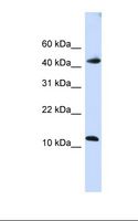 APOBEC3F / ARP8 Antibody - Fetal brain lysate. Antibody concentration: 1.0 ug/ml. Gel concentration: 10-20%.  This image was taken for the unconjugated form of this product. Other forms have not been tested.