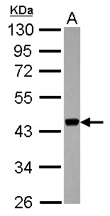 APOBEC3F / ARP8 Antibody - Sample (30 ug of whole cell lysate) A: Jurkat 10% SDS PAGE APOBEC3F antibody diluted at 1:1000