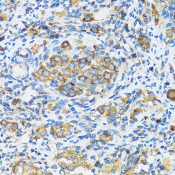 APOBEC3F / ARP8 Antibody - Immunohistochemistry of paraffin-embedded Rat ovary using APOBEC3F Polyclonal Antibody at dilution of 1:100 (40x lens).