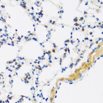 APOBEC3F / ARP8 Antibody - Immunohistochemistry of paraffin-embedded Mouse lung using APOBEC3F Polyclonal Antibody at dilution of 1:100 (40x lens).