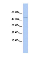 APOBEC3F / ARP8 Antibody - APOBEC3F antibody Western blot of OVCAR-3 cell lysate. This image was taken for the unconjugated form of this product. Other forms have not been tested.