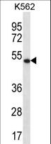 APOBEC3G / CEM15 Antibody - APOBEC3G Antibody western blot of K562 cell line lysates (35 ug/lane). The APOBEC3G antibody detected the APOBEC3G protein (arrow).
