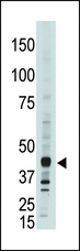 APOBEC3G / CEM15 Antibody - The anti-CEM15 antibody is used in Western blot to detect CEM15 in A375 cell lysate.