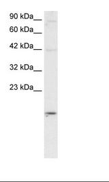 APOBEC3G / CEM15 Antibody - HepG2 Cell Lysate.  This image was taken for the unconjugated form of this product. Other forms have not been tested.