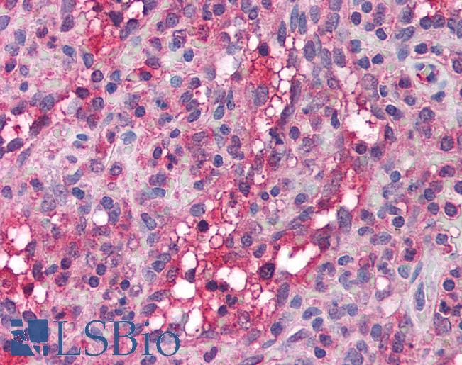 APOBEC3G / CEM15 Antibody - Anti-APOBEC3G antibody IHC of human spleen. Immunohistochemistry of formalin-fixed, paraffin-embedded tissue after heat-induced antigen retrieval. Antibody concentration 5 ug/ml.  This image was taken for the unconjugated form of this product. Other forms have not been tested.