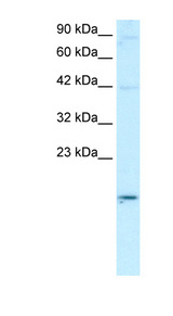 APOBEC3G / CEM15 Antibody - APOBEC3G antibody Western blot of Daudi lysate. This image was taken for the unconjugated form of this product. Other forms have not been tested.
