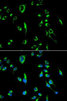 APOBEC3G / CEM15 Antibody - Immunofluorescence analysis of MCF7 cells.