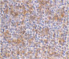 APOBEC3G / CEM15 Antibody - IHC of human spleen using APOBEC3G antibody at 1 ug/ml.