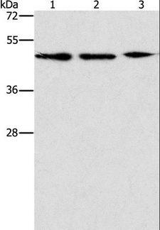 APOBEC3G / CEM15 Antibody - Western blot analysis of PC3, Jurkat and Raji cell, using APOBEC3G Polyclonal Antibody at dilution of 1:240.