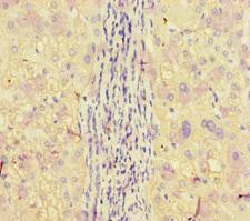 APOBEC3G / CEM15 Antibody - Immunohistochemistry of paraffin-embedded human liver tissue at dilution of 1:100