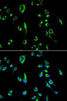 APOBEC3G / CEM15 Antibody - Immunofluorescence analysis of MCF-7 cells using APOBEC3G antibody. Blue: DAPI for nuclear staining.