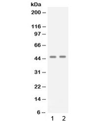 APOBEC3G / CEM15 Antibody - Western blot testing of 1) human A431 and 2) human Jurkat cell lysate with APOBEC3G antibody at 0.5ug/ml. Predicted molecular weight: ~46 kDa.