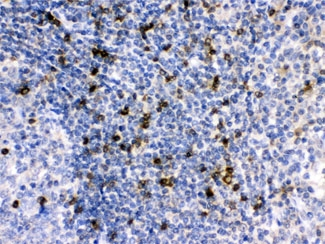APOBEC3G / CEM15 Antibody - IHC testing of FFPE human tonsil with APOBEC3G antibody at 1ug/ml. HIER: steam in pH6 citrate buffer and allow to cool prior to staining.