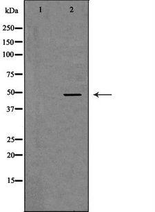 APOBEC3G / CEM15 Antibody - Western blot analysis of extracts of Jurkat cells using APOBEC3G antibody. The lane on the left is treated with the antigen-specific peptide.