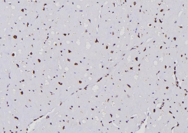 APOBEC3G / CEM15 Antibody - 1:100 staining human heart tissue by IHC-P. The sample was formaldehyde fixed and a heat mediated antigen retrieval step in citrate buffer was performed. The sample was then blocked and incubated with the antibody for 1.5 hours at 22°C. An HRP conjugated goat anti-rabbit antibody was used as the secondary.