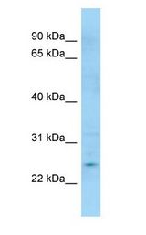 APOBEC3H Antibody - APOBEC3H antibody Western Blot of Jurkat.  This image was taken for the unconjugated form of this product. Other forms have not been tested.
