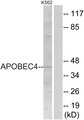 APOBEC4 Antibody - Western blot analysis of lysates from K562 cells, using APOBEC4 Antibody. The lane on the right is blocked with the synthesized peptide.
