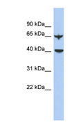 APOBEC4 Antibody - APOBEC4 antibody Western blot of Fetal Lung lysate. This image was taken for the unconjugated form of this product. Other forms have not been tested.