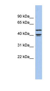 APOBEC4 Antibody - APOBEC4 antibody Western blot of Fetal Brain lysate. This image was taken for the unconjugated form of this product. Other forms have not been tested.