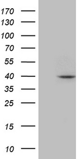 APOBEC4 Antibody - HEK293T cells were transfected with the pCMV6-ENTRY control. (Left lane) or pCMV6-ENTRY APOBEC4. (Right lane) cDNA for 48 hrs and lysed. Equivalent amounts of cell lysates. (5 ug per lane) were separated by SDS-PAGE and immunoblotted with anti-APOBEC4. (1:2000)