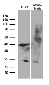 APOBEC4 Antibody - Western blot analysis of extracts. (35ug) from HT29 cell line and mouse testis tissue lysate by using anti-APOBEC4 monoclonal antibody. (1:500)