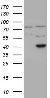 APOBEC4 Antibody - HEK293T cells were transfected with the pCMV6-ENTRY control. (Left lane) or pCMV6-ENTRY APOBEC4. (Right lane) cDNA for 48 hrs and lysed. Equivalent amounts of cell lysates. (5 ug per lane) were separated by SDS-PAGE and immunoblotted with anti-APOBEC4. (1:500)