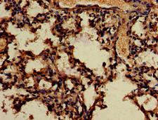 APOBEC4 Antibody - Immunohistochemistry of paraffin-embedded human lung tissue using APOBEC4 Antibody at dilution of 1:100