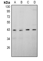APOBEC4 Antibody - Western blot analysis of APOBEC4 expression in rat testis (A), mouse testis (B), MCF7 (C), PC3 (D) whole cell lysates.