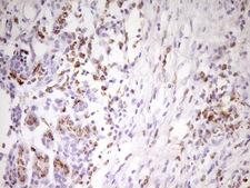 APOBR / APOB48R Antibody - Immunohistochemical staining of paraffin-embedded Human pancreas tissue within the normal limits using anti-APOBR mouse monoclonal antibody. (Heat-induced epitope retrieval by 1 mM EDTA in 10mM Tris, pH8.5, 120C for 3min,