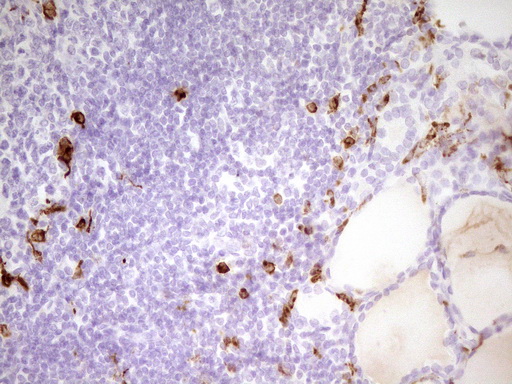 APOBR / APOB48R Antibody - Immunohistochemical staining of paraffin-embedded Human thyroid tissue within the normal limits using anti-APOBR mouse monoclonal antibody. (Heat-induced epitope retrieval by 1 mM EDTA in 10mM Tris, pH8.5, 120C for 3min,