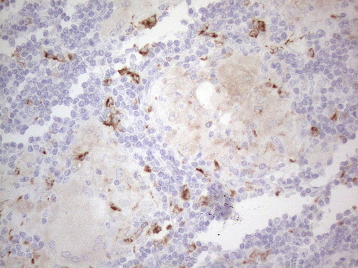 APOBR / APOB48R Antibody - Immunohistochemical staining of paraffin-embedded Human lymph node tissue within the normal limits using anti-APOBR mouse monoclonal antibody. (Heat-induced epitope retrieval by 1mM EDTA in 10mM Tris buffer. (pH8.5) at 120°C for 3 min. (1:150)