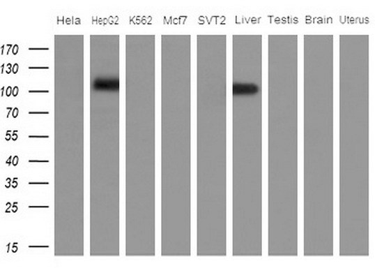 APOBR / APOB48R Antibody - Western blot analysis of extracts. (10ug) from 5 different cell lines and 4 human tissue by using anti-APOBR monoclonal antibody. (1: Hela; 2: HepG2; 3: K562; 4: Mcf7; 5: SVT2; 6: Liver; 7: Testis; 8: Brain; 9: Uterus)at 1:200 dilution.
